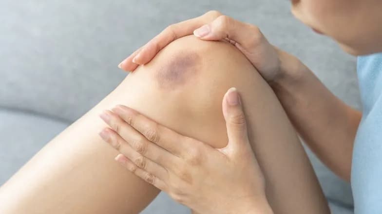 Skuteczne sposoby na stłuczenia dla dziecka – jak pomóc maluchowi